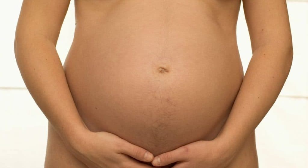 embarazo y varices